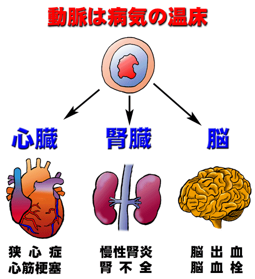 artery.gif (53534 oCg)